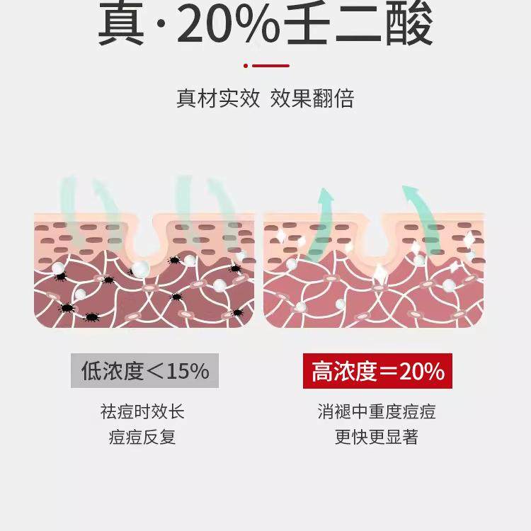壬二酸凝胶百分之20祛乳膏痘印黑色素黑头收缩毛孔医正品用型凝露,淘宝优惠券,粉丝福利购,淘宝优惠卷