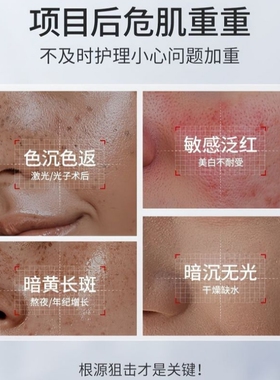 氨甲环酸乳膏凝胶官方去黄褐斑湿敷溶液传明酸凝胶分解黑色素