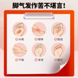 达克宁 Тербинафиновый гидрохлоридный кремовый кремовый спрей для облегчения зуда и о онихомикоза грибковой инфекции