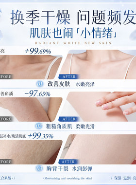 果酸VE尿素霜去鸡皮肤乳膏护手霜维E补水淡黑滋润身体乳官方正品