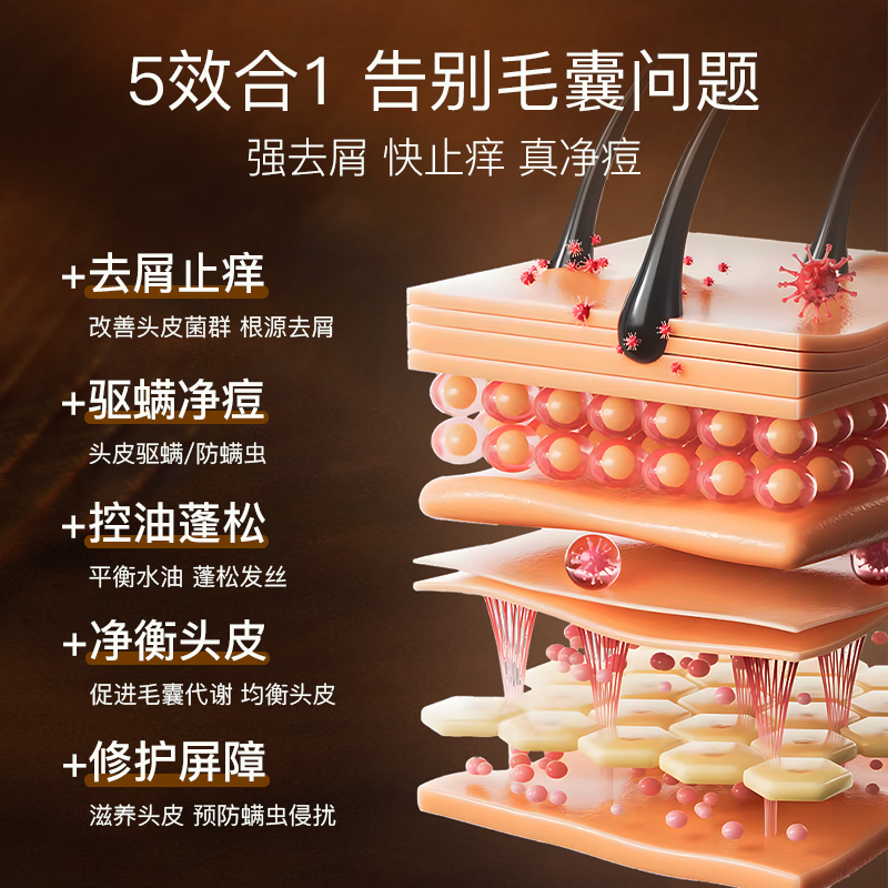 二硫化硒去屑止痒毛囊洗发水头痒有疙瘩中药炎专用液露官方旗舰店