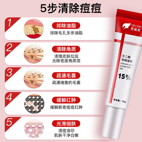 壬二酸凝胶15%去祛痘膏祛痘印淡化坑任水杨酸收缩毛孔非粉刺黑头 - 图0