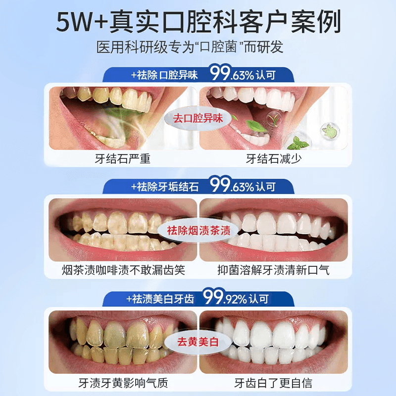 幽门螺旋杆菌非四联医用牙科分离剂抗过敏去口臭口腔抑菌杀菌正品 - 图0