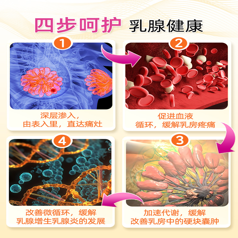 乳腺结节散结贴疏通散结硬块囊肿乳房乳腺炎增生乳腺贴非热敷贴包 - 图2