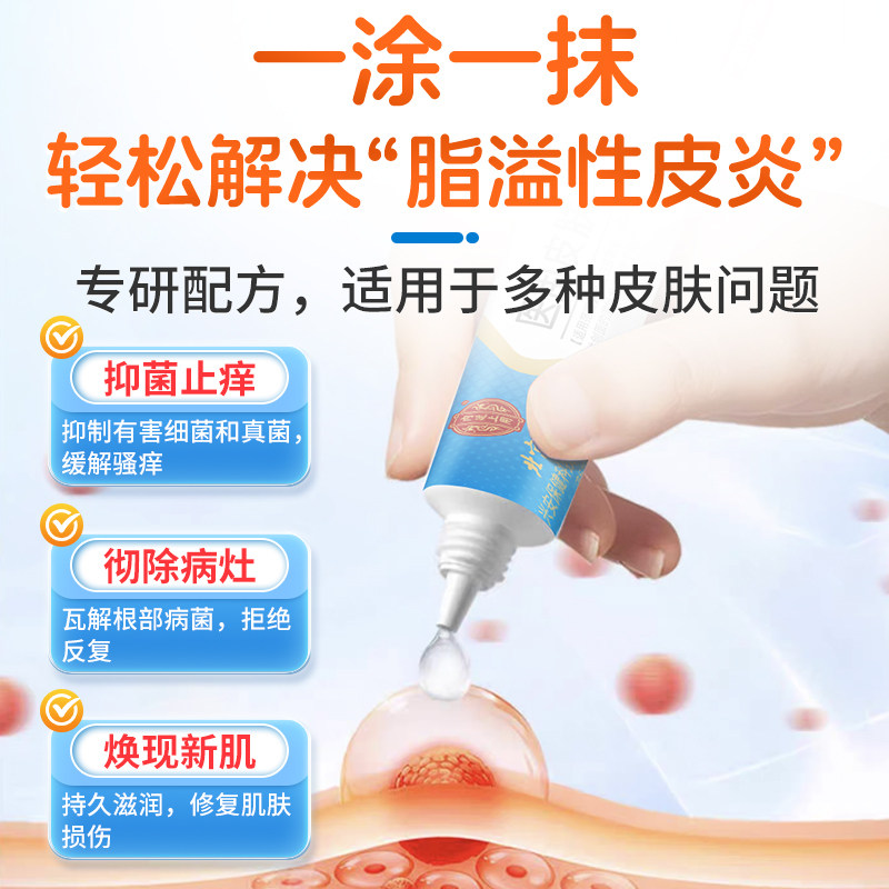 医用软膏脂溢性皮炎鼻翼面部两侧泛红痒外用止痒顽固无激素膏药,淘宝优惠券,粉丝福利购,淘宝优惠卷