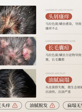 苦楝油苦楝子头皮预洗精华油护发精油清洁毛囊炎护理营养液基础油