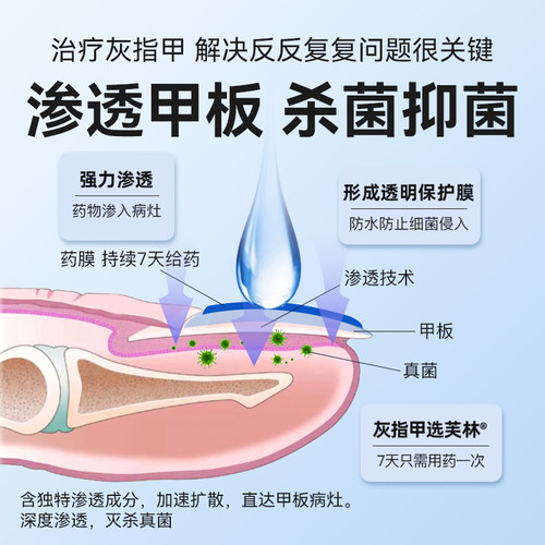 芙林盐酸阿莫罗芬搽剂专用感染旗舰店灰指甲正品官方真菌擦剂溶液 - 图1