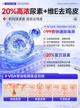 【药房直售】20%尿素霜去鸡皮!