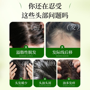 北京同仁堂侧柏叶何首乌中药材洗发粉植物生姜洗头粉包控油止痒