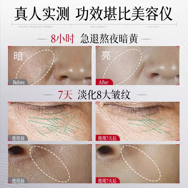 黑绷带面霜正品官方紧致抗皱抗衰老保湿滋润补水乳修复玻色因眼霜