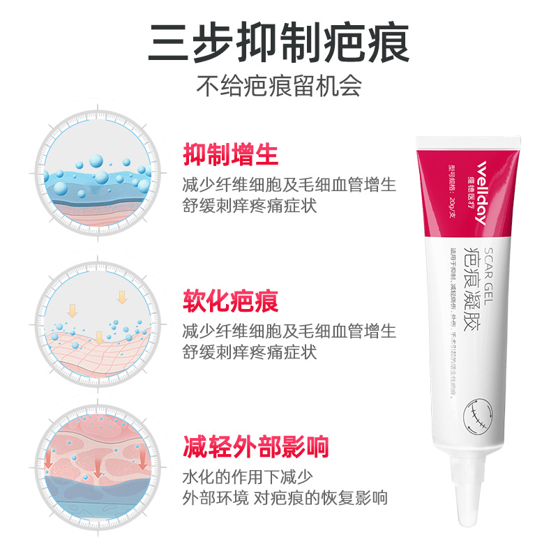 维德医用硅酮疤痕凝胶敷料修复增生凸起淡化剖腹产儿童成人祛疤膏