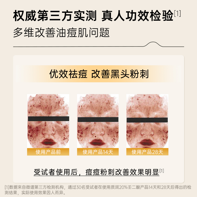 质润20%壬二酸凝胶任二凝酸凝胶祛痘去黑头闭口百分之20清痘凝露