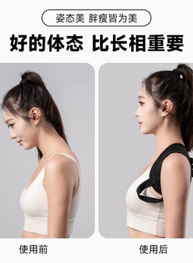 【官方热销正品】驼背矫正器女士