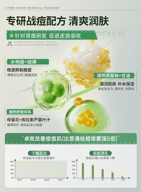 【药房直售】水杨酸硫祛痘喷雾