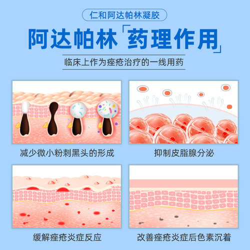 阿达帕林凝胶正品官方旗舰店祛痘药膏林啊达帕林凝胶达怕痘痘药膏 - 图1