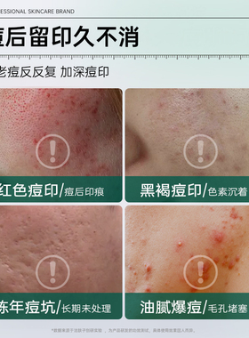 积雪草复颜舒缓膏霜苷软膏祛痘印坑熊果苷乳霜膏凝胶去黄提亮面霜
