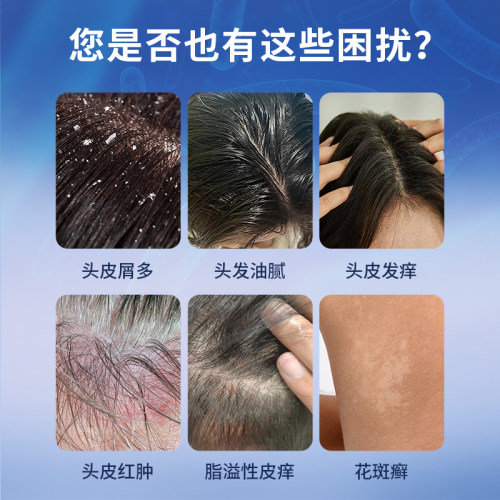 希尔生二硫化硒洗剂二硫化硒洗头水控油洗发水头皮屑专用洗发液 - 图0