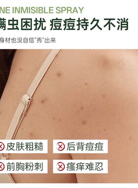 【背痘救星】去前胸后背痘痘神器