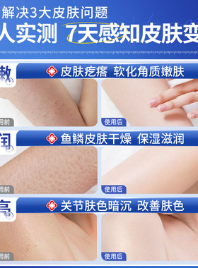 科学去鸡皮肤改善关节黑CP神器