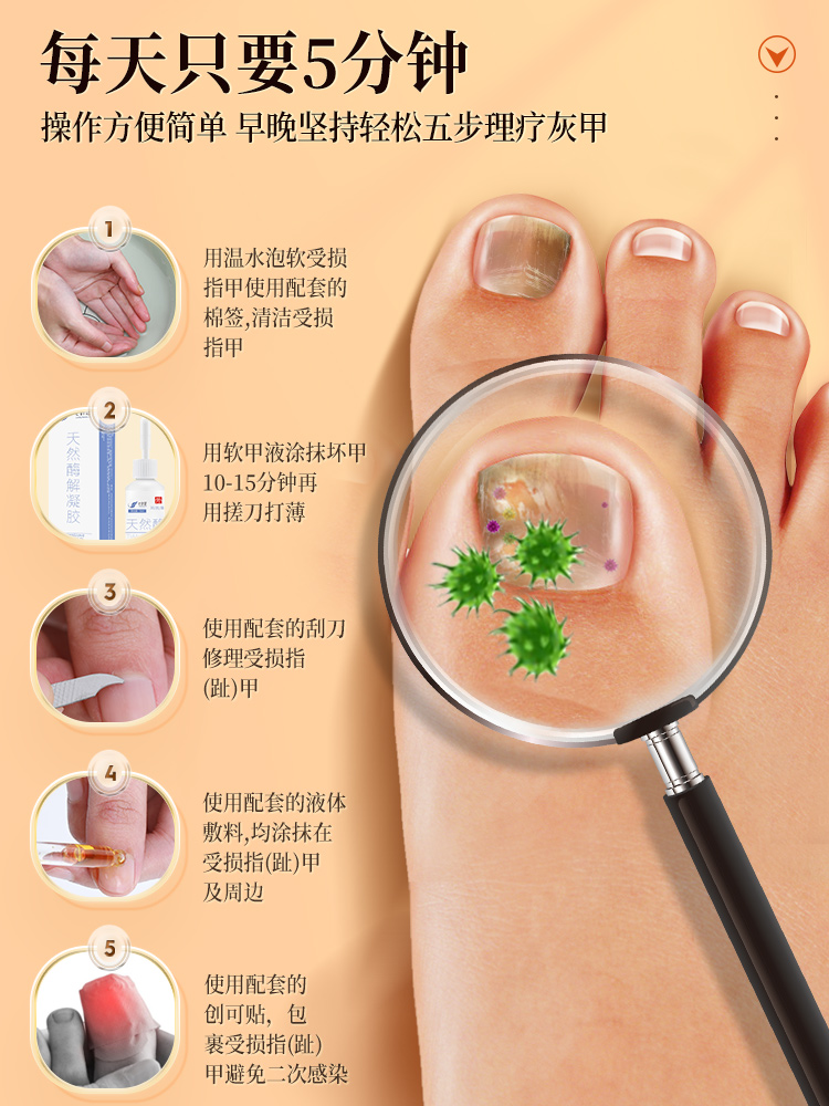 同仁堂灰指甲脱甲膏液冰醋酸修甲 阿里健康大药房保健理疗