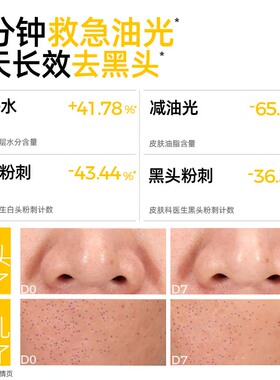 C咖水杨酸棉片祛痘控油去闭口粉刺角质淡印温和清洁保湿舒润湿敷