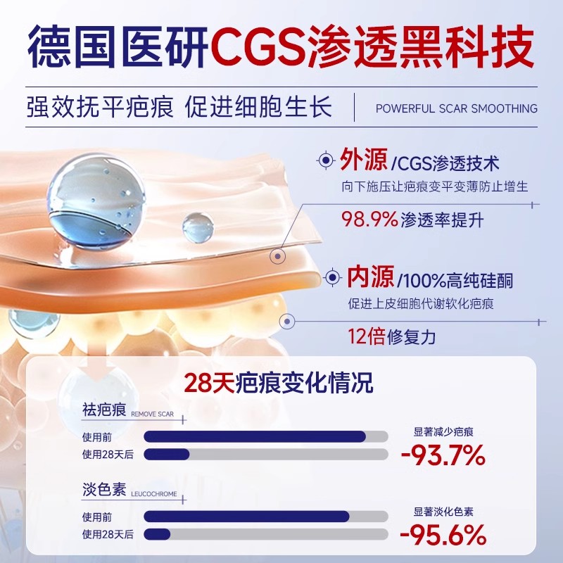 疤痕贴医用剖腹产术后伤口防水隐形甲状腺除凸减张硅酮凝胶祛疤贴