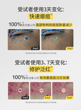 羽素清肤净痘夜间次抛精华液祛痘淡化痘印保湿修护男女肌肤敏感肌