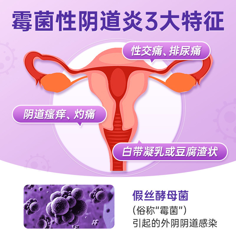 克霉唑栓阴道栓片克霉唑阴道片正品霉菌阴道炎妇科用药阴道,淘宝优惠券,粉丝福利购,淘宝优惠卷