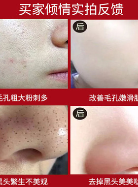 乳糖酸毛孔收缩精华液去黑头导出液毛孔收敛补水保湿代发原液