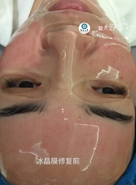 舒缓冷敷暨冰晶膜美容院修护膜