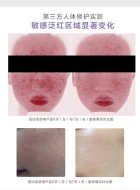 养出饱满厚皮，敏肌舒缓修护霜