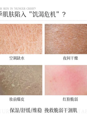 ZUZU壳聚糖舒缓保湿喷雾
