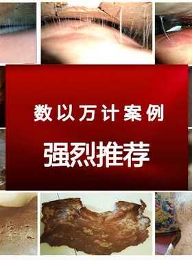 拔丝热灸膏泥灸透骨灸膜宫廷热膜古方热膜百草热膜