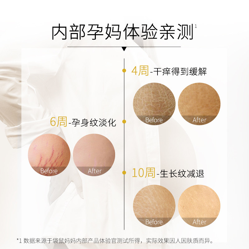 袋鼠妈妈孕妇橄榄油淡化修护舒缓霜 袋鼠妈妈嫩绿儿妊娠纹护理