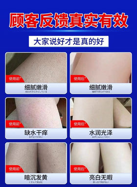 身体乳去鸡皮疙瘩毛囊角质磨砂膏