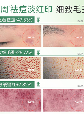 膜法世家绿豆泥膜深层清洁控油祛痘淡印去黑头涂抹式泥浆面膜正品