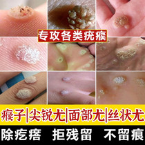 5% % Mimiquimot cream Filamentous Wart Miquemot Warts Paste Flat Wart Ointment Flagship Store  