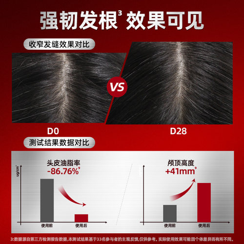 Alpecin欧倍青德国咖啡因洗发水男清爽控油蓬松强韧无硅油洗发露 - 图0