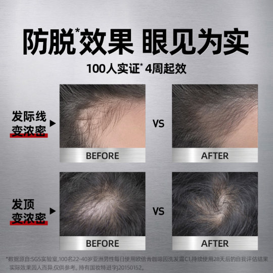 Caffeine anti-hair loss shampoo