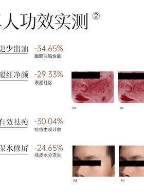 致己新颜轻肌调理菁华液50ml