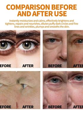 Eye Cream Remove Eye Bags Puffiness Dark Circles Collagen An