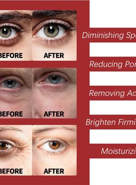 Retinol Wrinkle Removing Cream Anti Aging Firming Lifting