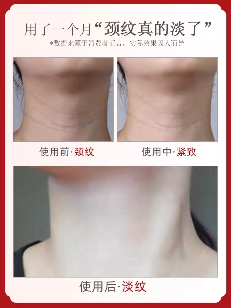 颈膜贴提拉紧致淡化抗皱去颈纹面膜-图0