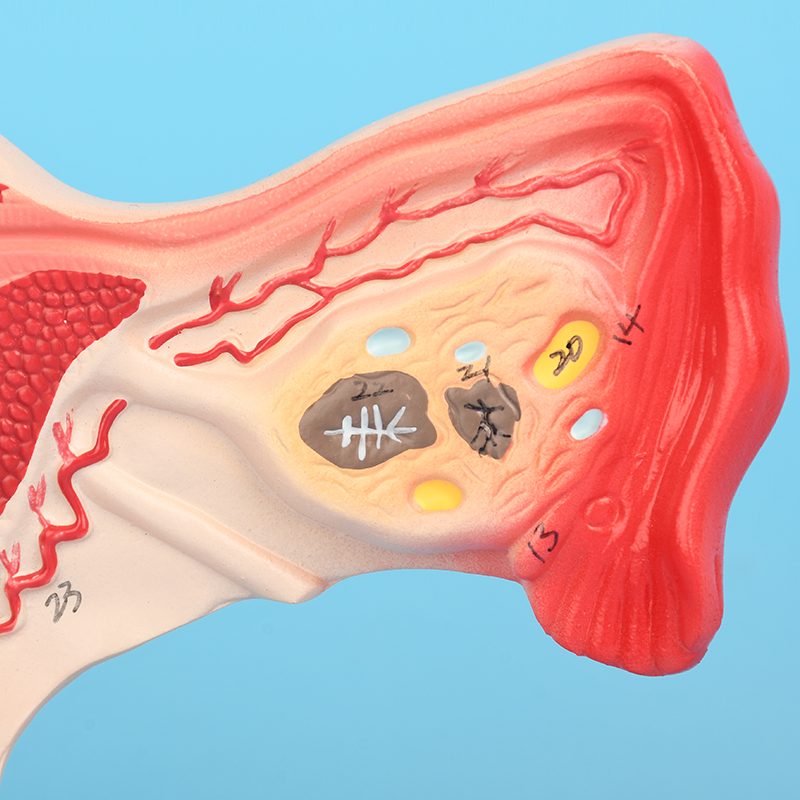 医学女性生殖子宫解剖病理模型人体阴道卵巢教学妇科培训教具 - 图1