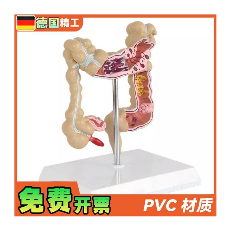 德国】仿真人体结肠大肠解剖模型肛肠科肠道肠胃消Z化系统教学 - 图3