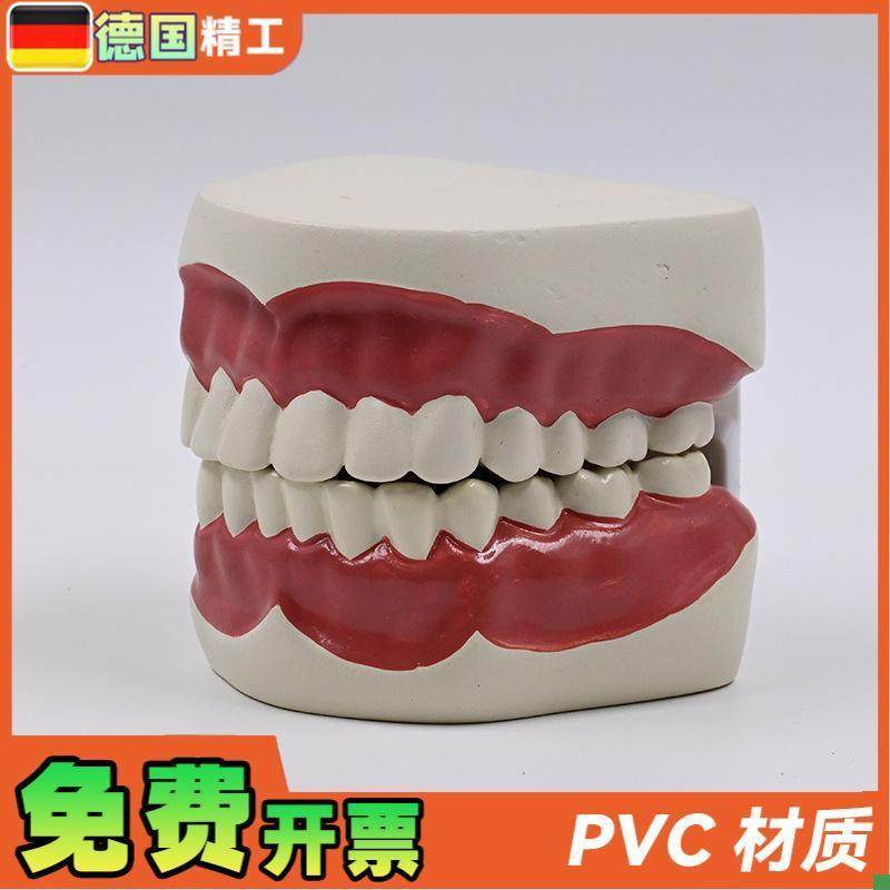 德国】1比1牙齿护理保健模型高级口腔清洁模型保健牙护.理教学模 - 图1