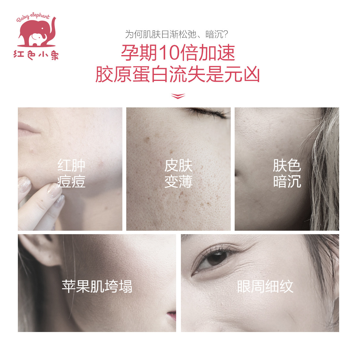 红色小象孕妇护肤品哺乳期可用补水 红色小象创禾面部套装