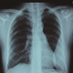 X-ray CT film printing dental viewing film