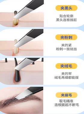 细胞夹去黑头工具眉毛夹镊子