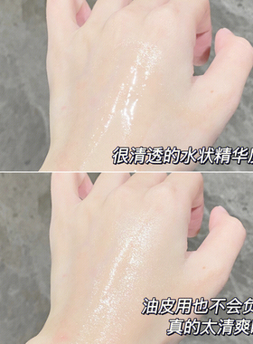 达尔肤杏仁酸精华液8%30ml